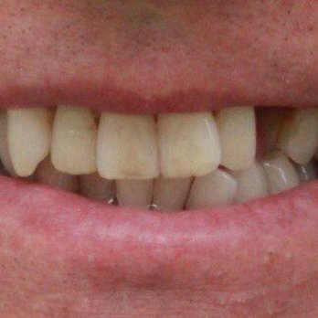 A+ Dentistry - General Dentistry Near Me - Canton, Michigan