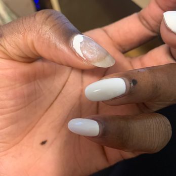 Ryna's Nails - Nails peeled in less than a week - Nail Technicians Near Me - Etobicoke, Ontario