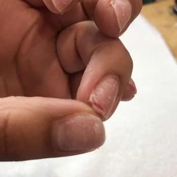 Le Nails Spa - Nail she broke. - Nail Salons Near Me - Vacaville, California