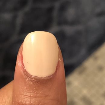 Top 2 Nail - Lumpy, messy, poorly done, uneven - Nail Salons Near Me - Pelham, New York Top 2 Nail - Lumpy, messy, poorly done, uneven - Nail Salons Near Me - Pelham, New York