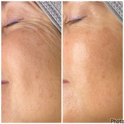 LaRaydiance Wellness Spa Boutique - Age management, fine lines