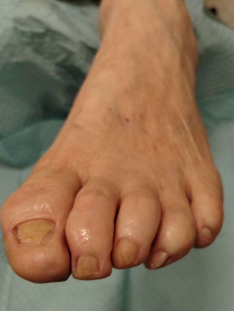YOLO Medical Pedicure Logo