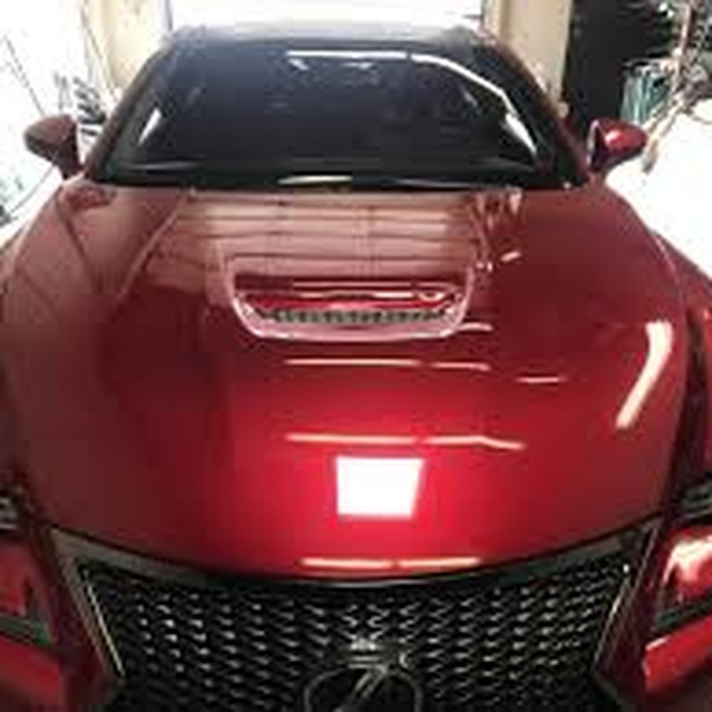 GlassAid - My baby post op - Auto Glass Services Near Me GlassAid - My baby post op - Auto Glass Services Near Me