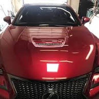 GlassAid - My baby post op - Auto Glass Services Near Me