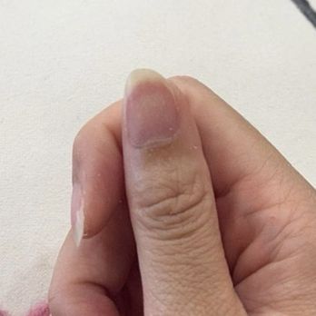 Irvine Nails - closer look at the uneven thumb - Nail Salons Near Me - Irvine, California