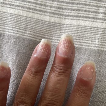 PAINT Nail Bar - White dots on my hands and feet after removing polish - Nail Salons Near Me - Naples, Florida