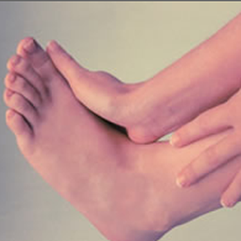 Park Slope Podiatry: Michael Nagelberg, DPM - Podiatrists Near Me - Brooklyn, New York