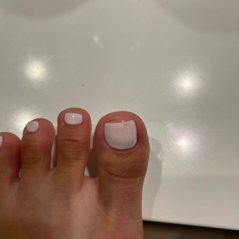 2EM Nail Place - My slanted toe mail and the cut she gave me - Nail Salons Near Me - Irvine, California