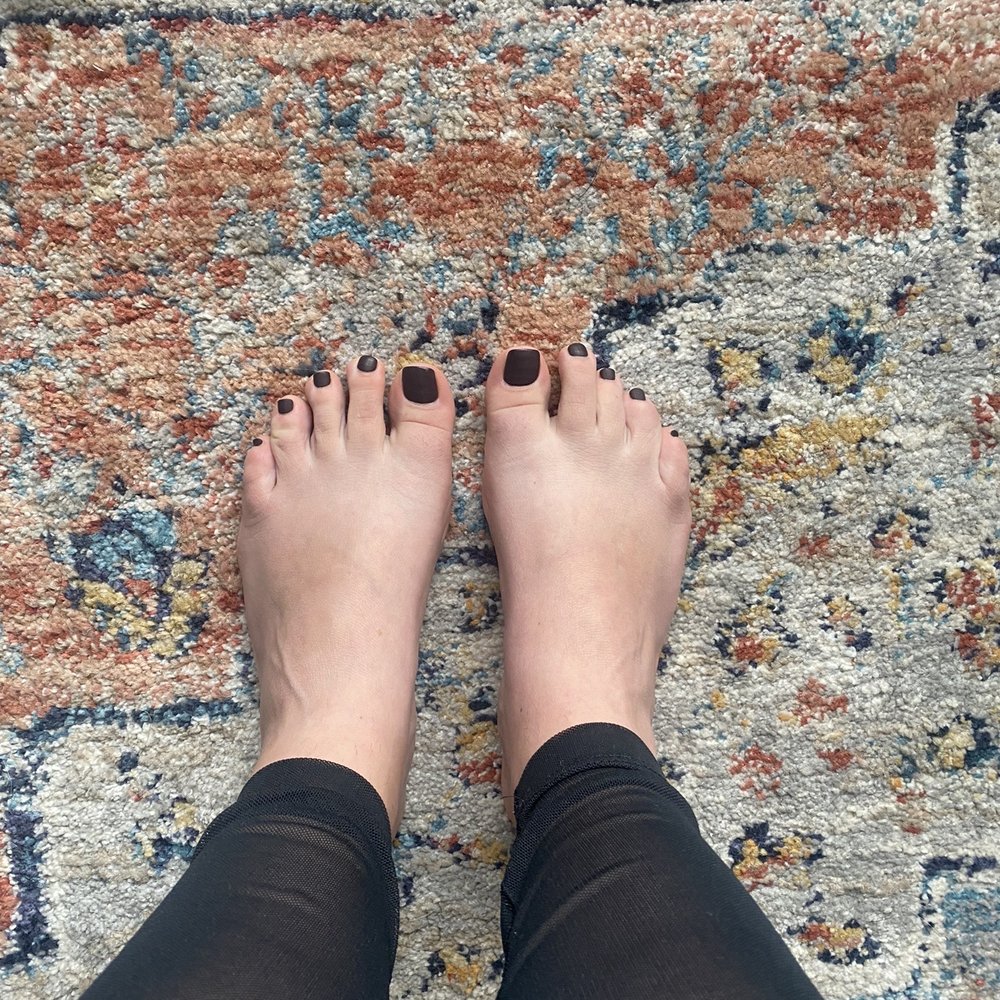 5 days post pedi 5 days post pedi