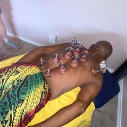 Therapeutic Connection - Cupping Physical Therapy Waikoloa Hawi Kapaau Kona Waimea Physical Therapist