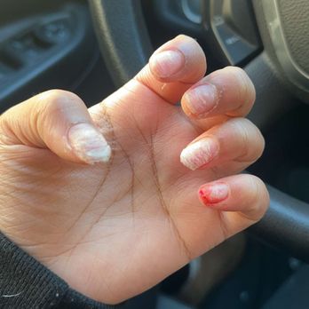 Luvz Nails Salon - after i bit them off - Nail Salons Near Me - Bethlehem, Pennsylvania