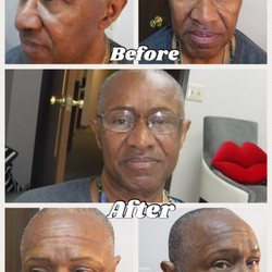 Microblading Hand Held Device This is My Dad during his 1st Vist