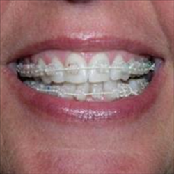 Androscoggin Dental Care