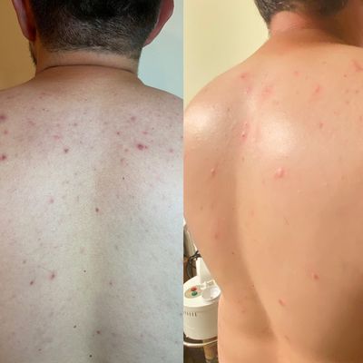 Mirame Skin Treatments by null