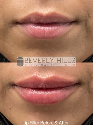 Beverly Hills Rejuvenation Center Westlake Village by null