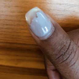 Photo taken 1.5 week after a gel acryclic refill and preparing to remove the gel. But all nails started chipping gradually after 4 days.