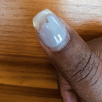 Diamond Nails Spa - Photo taken 1.5 week after a gel acryclic refill and preparing to remove the gel. But all nails started chipping gradually after 4 days. - Nail Salons Near Me - Boston, Massachusetts