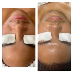 Desembre Hawaii - Here's my photos from when she did my facial, just look at that glow!