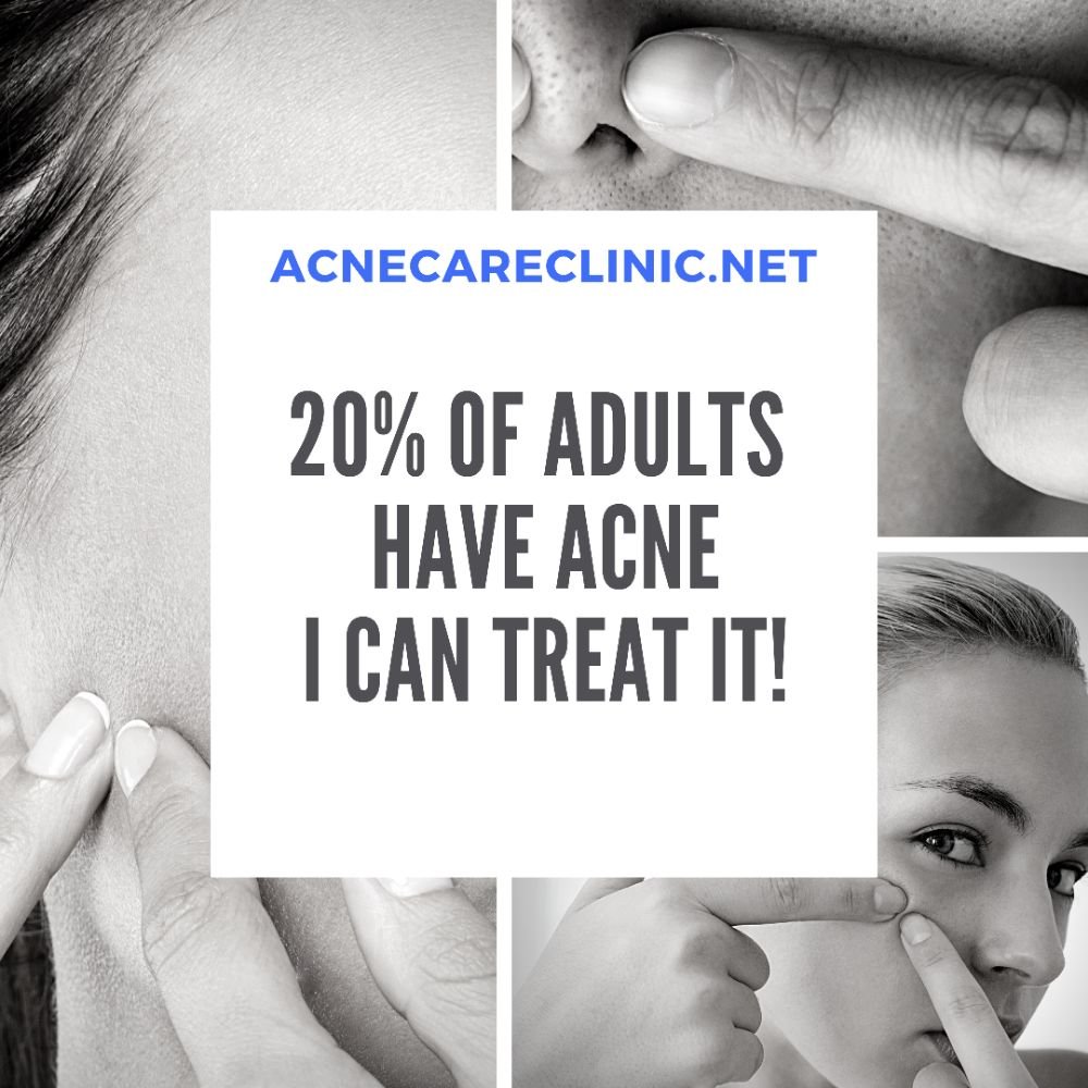 acne care clinic
