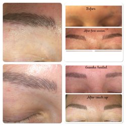 Serenity Springs Salon and Spa - Microblading on a beautiful lady who had lost most of her brows :)