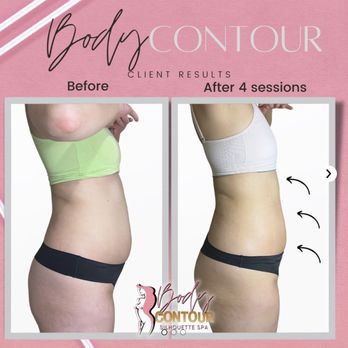 The Body Contour Spa - Body Contouring Near Me - Vancouver, British Columbia The Body Contour Spa - Body Contouring Near Me - Vancouver, British Columbia