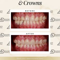 Elevate Dental BSO -  BGC