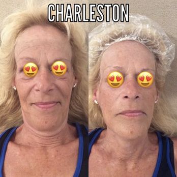 Center Stage Spa - Medical Spas Near Me - Charleston, South Carolina Center Stage Spa - Medical Spas Near Me - Charleston, South Carolina
