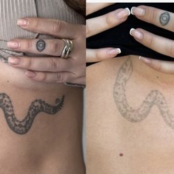 Swamp Mermaid Beauty Project - Laser Tattoo Removal *after 4 sessions