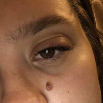 Christine Lash Studio - Major swelling and itching this day. I tried to take Benadryl and apply it topically but nothing helped - Eyelash Service Near Me - New York, New York Christine Lash Studio - Major swelling and itching this day. I tried to take Benadryl and apply it topically but nothing helped - Eyelash Service Near Me - New York, New York