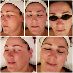 Crystal Pure Skin Care - Beautiful skin with Hydrating facial treatment ~