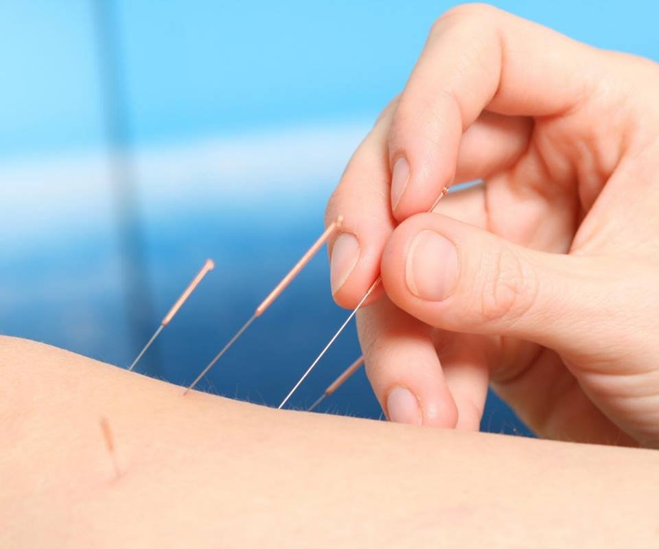 PATTY JOHNSON’S ACUPUNCTURE AND HERBS Updated April 2024 17 Reviews 8645 Haven Ave, Rancho