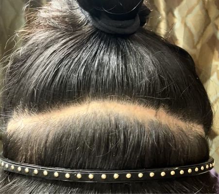 BEVERLY HILLS TRANSGENDER SURGERY: DR. ALEXANDER SINCLAIR - Updated ...