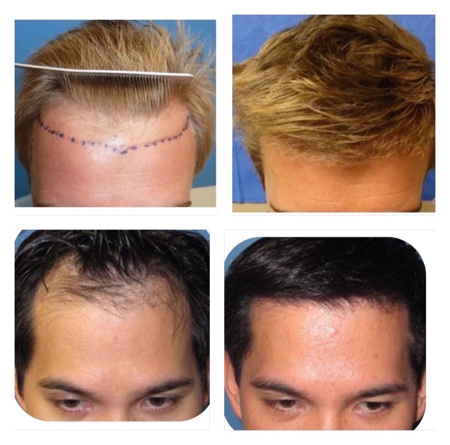 MESHKIN MEDICAL HAIR RESTORATION CLINIC 356 Photos & 48 Reviews 2121 San Joaquin Hills Rd