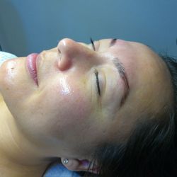 Lala Aesthetics - Client after a facial that included dermaplaning and an enzyme treatment, along with a brow tint and lamination!