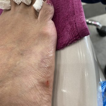NT Nail Spa - Cut on right foot - Waxing Near Me - Manteca, California NT Nail Spa - Cut on right foot - Waxing Near Me - Manteca, California