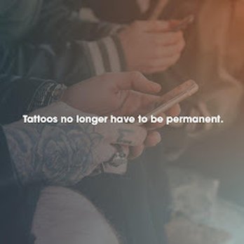 Removery Tattoo Removal & Fading - Tattoo Removal Near Me - Surrey, British Columbia Removery Tattoo Removal & Fading - Tattoo Removal Near Me - Surrey, British Columbia