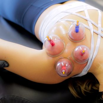 Milestones Movement Therapy - Myofascial Cupping Therapy - Trainers Near Me - Davis, California Milestones Movement Therapy - Myofascial Cupping Therapy - Trainers Near Me - Davis, California