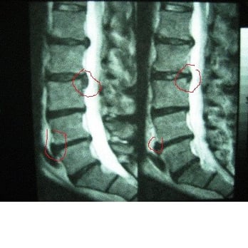 Chris Wilkerson, DC - Before and After Treatment - Chiropractors Near Me - Carson, California Chris Wilkerson, DC - Before and After Treatment - Chiropractors Near Me - Carson, California