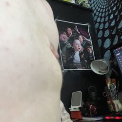 Appleton Plastic Surgery Center, SC - 3 month post op side view