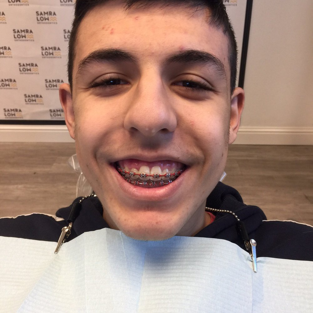 Before Before