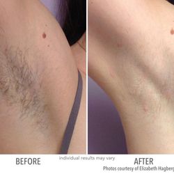 The Laser Beauty Spot - I love this place , great interior an great results   My wife did Laser removal an saw great results . Highly recommend this place