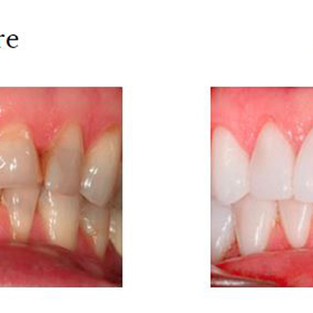 Spectrum Dental - Pediatric Dentists Near Me - Baltimore, Maryland Spectrum Dental - Pediatric Dentists Near Me - Baltimore, Maryland