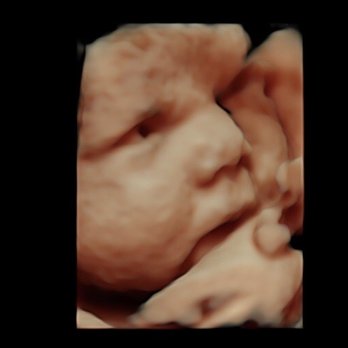 Advanced Ultrasound Services - Diagnostic Imaging Near Me - Tampa, Florida Advanced Ultrasound Services - Diagnostic Imaging Near Me - Tampa, Florida