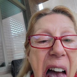 Westwind Dental - Phoenix - Severe tongue injury during root canal. Filed claim. No response. No manager seems to ever be available or in office. Beware.