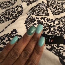 Chipped pointer finger