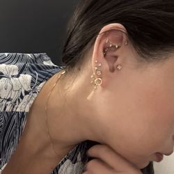 Golden Dermatology - My ear now (September 2025) fully healed.