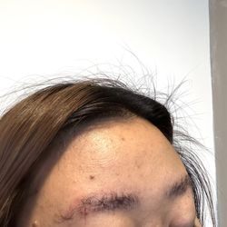 Lash Love - You guys over plucked my brows to the point of visible patches and the brow lamination caused red bumps, itching and dryness. Stay away