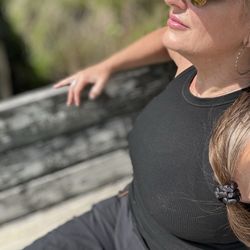 BodyLase Med Spa - Few weeks After lip fillers