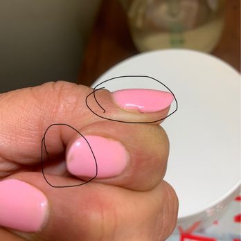 Unique Nail Spa - Notice uneven dip pattern on thumb, divot in finished nail. - Nail Salons Near Me - Tahoe City, California Unique Nail Spa - Notice uneven dip pattern on thumb, divot in finished nail. - Nail Salons Near Me - Tahoe City, California