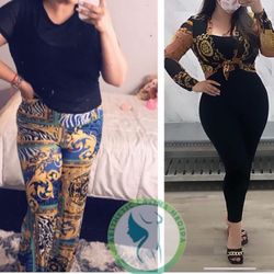 Latina Medical Center - Here is the before and after.